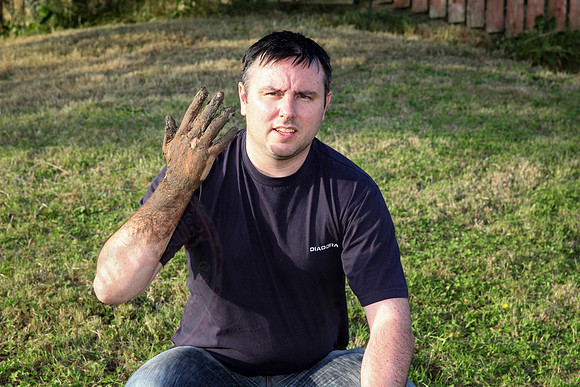 Photos of myself after I pushed my arm into the lawn on the 1st July 2014.