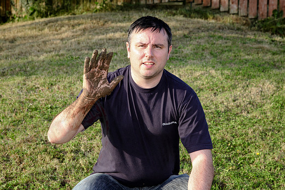 Photos of myself after I pushed my arm into the lawn on the 1st July 2014.