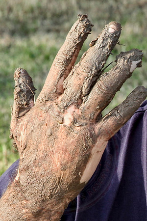 Photos of myself after I pushed my arm into the lawn on the 1st July 2014.