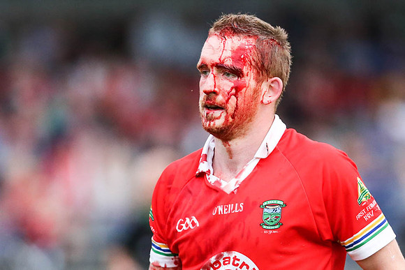 James Maguire is bloodied in Roslea V Newtownbutler in Senior GAA Championship 130816 29