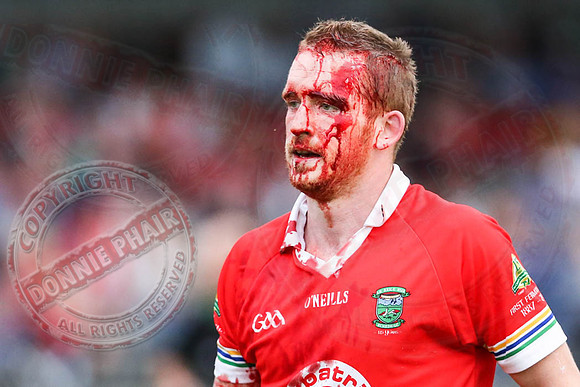 James Maguire is bloodied in Roslea V Newtownbutler in Senior GAA Championship 130816 29